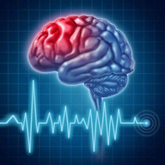 Diferențe în accident vascular cerebral ischemic, cauze, factori de risc