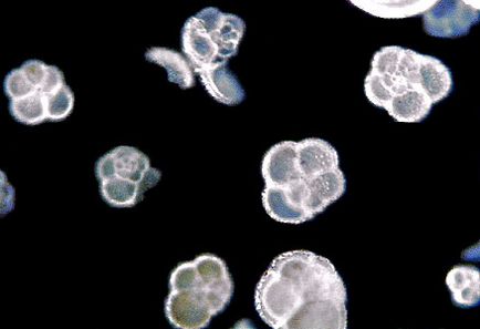 Ordinea amoeba scoică (testacea)