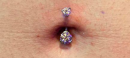 Bauchnabelpiercing különösen szúrás, gondozás és fotó (defekt) Köldök piercing szúrás különösen, ellátás és fotó