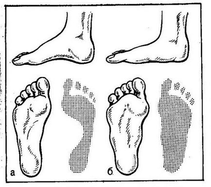 Picior în foaia copiilor preșcolari, modul de identificare a acestora (semne ale unei fotografii)