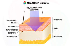 De ce molia se exfoliază - cauzele principale, pericolul și tratamentul