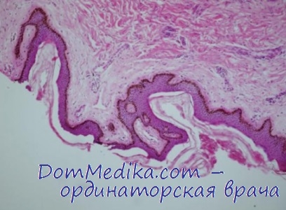 Ознаки патології епідермісу