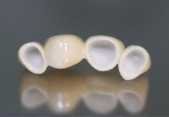Protézis, tuberkulin (bitrix) Protézis, tuberkulin