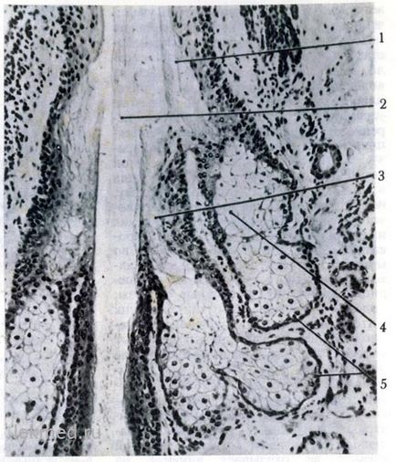 Glandele sebacee - sisteme corporale (histologie)