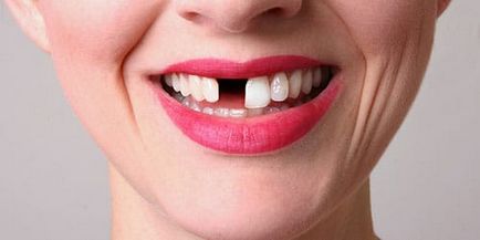 Dentiții albi străluciți prin care dinții albi visează într-un vis
