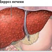 Etapele de ciroză hepatică, decompensare și stadiul final