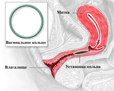 Uscarea vaginului determina cum sa scapati de droguri si de tratament