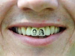 Tattoo pe dinți