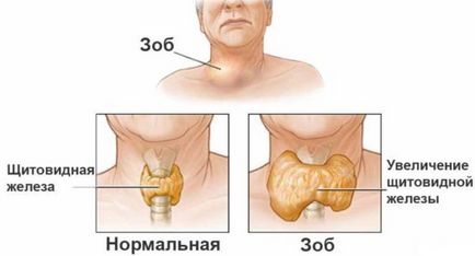 Hormonii tiroidieni, ceea ce este, funcționează