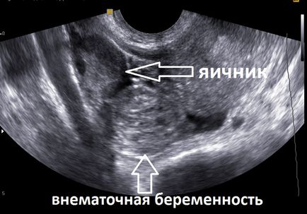 Uzi mic pelvis la femei, care arată concluzia, transcrierea