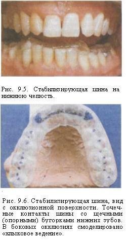 Tipuri de dispozitive medicale de diagnostic