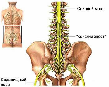 Tipuri de nevrită, simptome ale inflamației acute și cronice a nervilor, cauze