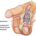 Boli oculare alergice - simptome și tratament pentru conjunctivită