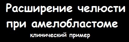 Амелобластома ротової порожнини