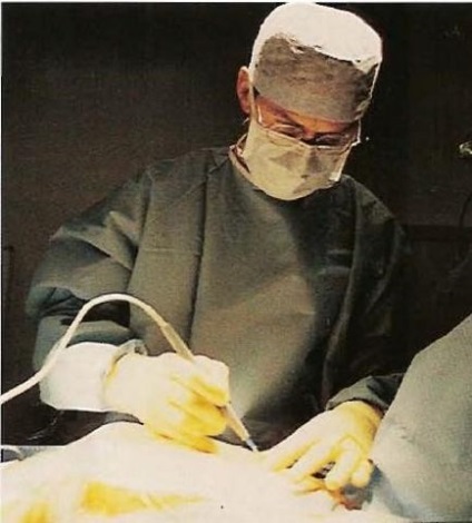 Operație by-pass aortocoronară