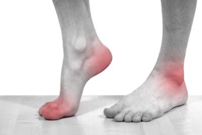 Fájó láb a láb járás közben és nyugalmi (az oldalon, a közepén) az oka annak, hogy ezt