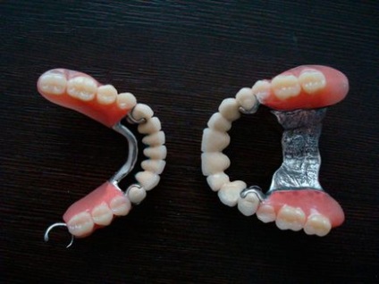 Recenzii Bugelnye dentures, preturi, rezultate foto