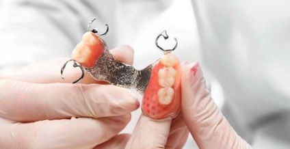Бюгельні зубні протези відгуки, ціна, фото результату