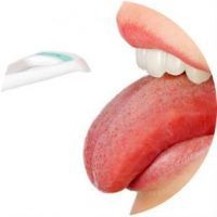 Чим лікувати білі виразки в роті у дитини або дорослого