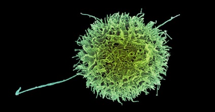 Mi az a természetes ölősejtek egészségügyi környezetben