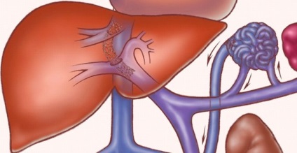 Cirrhosis kezelés népi jogorvoslati és módszerek