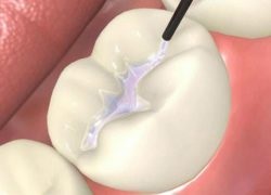 Stomatologie stomatologică - stomatologie - Yaroslavl - tratament fără frică și durere