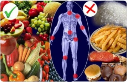Dieta cu principiile nutriției artritei reumatoide, alimentele permise și interzise