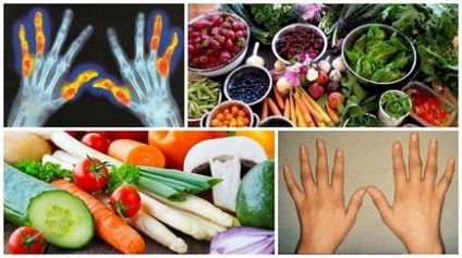 Dieta pentru articulatiile de artrita reumatoida, nutritie terapeutica si meniuri pentru artrita reumatoida