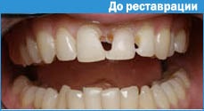 Fényképfelvétel a szájüregben, mint a beteg motivációja eszköz (fényképezni a szájüregben, mint a beteg motiváció azt jelenti) Fotózni a szájban, mint egy olyan beteg motivációja