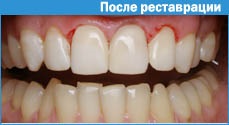 Fotografierea în cavitatea orală ca mijloc de a motiva pacientul