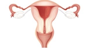 Hiperplazia endometrului ce este și cauzele patologiei