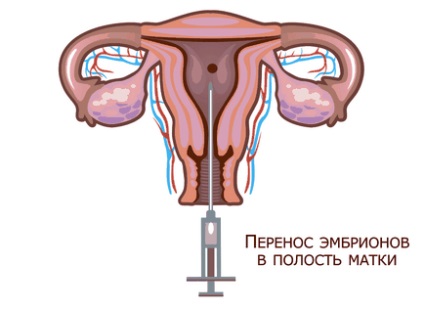 Inseminarea artificială a unui ou, cât costă să faci valoare ecologică într-o clinică de altravita