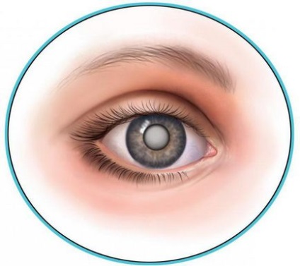 Istoricul cazurilor de oftalmologie