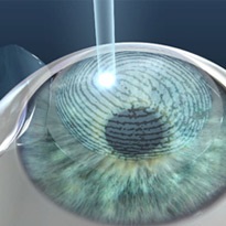 Історія методів лікування проблем з очима