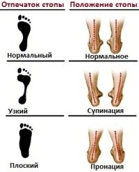 Якісні і бюджетні кросівки або до чого тут конопля