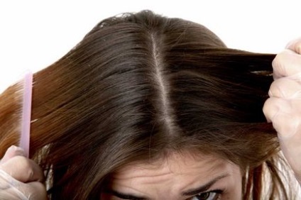 Як позбутися від лупи і випадання волосся в домашніх умовах швидко і ефективно