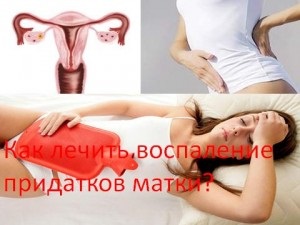 Як лікувати запалення придатків матки