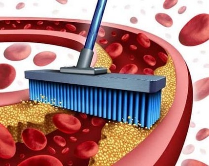 Как да се чисти на кръвоносните съдове в дома бързо и ефективно
