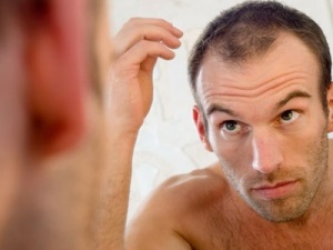 Як проводиться пересадка волосся безшовним методом особливості процедури, ціна