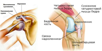 Cum să păstrați articulațiile și ligamentele sănătoase în timpul antrenamentului Sfaturi utile