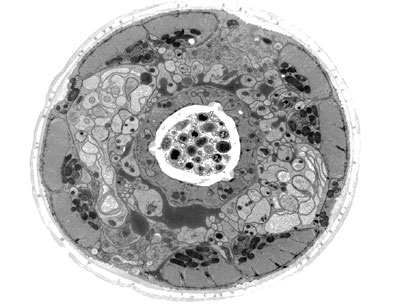 Microscopia cu crisoele electronice cum se vede mai mult, știința și viața