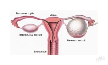 Кт органів малого таза - опис і адреси медичних центрів