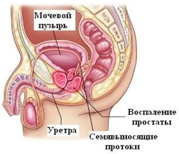 Кт органів малого таза - опис і адреси медичних центрів