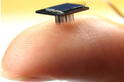 Microchip, care va ajuta persoanele cu dizabilități să se întoarcă pe picioare - de înaltă tehnologie și avansate