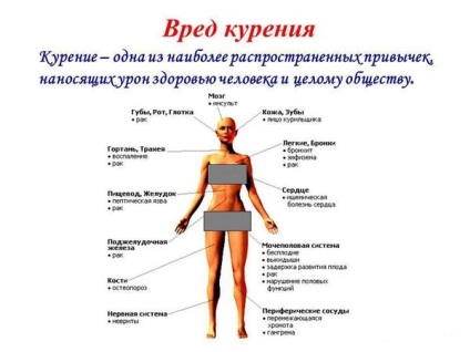 Чи можна курити при цукровому діабеті 2 типу, наслідки