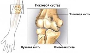 Imaginea clinică generală a bolilor articulației cotului