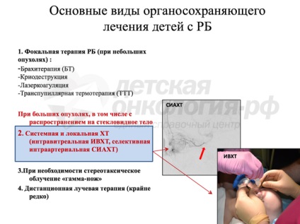 Oftalmologia oftalmologică a câinelui Mare