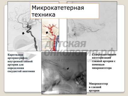 Oftalmologia oftalmologică a câinelui Mare