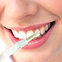 Albirea dinților la domiciliu cu remedii folclorice
