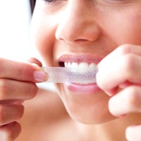 Albirea dinților la domiciliu cu remedii folclorice